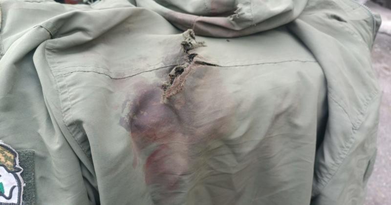 В Україні зафіксували захворювання, яке не спостерігалося з часів Першої світової війни, повідомляє The Telegraph.